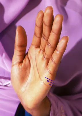 Линия брака на руке у женщины и мужчины: фото, расположение, значение,  расшифровка