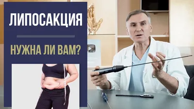 Липосакция рук: Фото для каталога