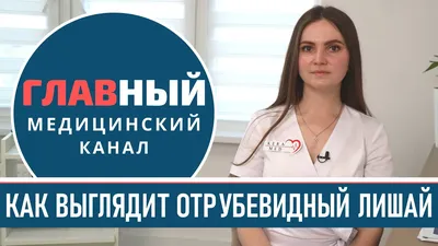 Изображение кожного заболевания на руке