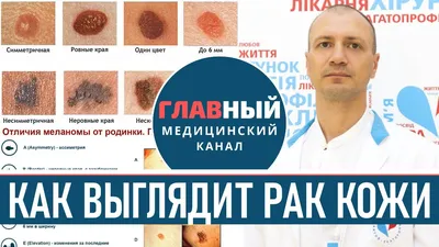 Лишай на руке: фото для медицинских блогов