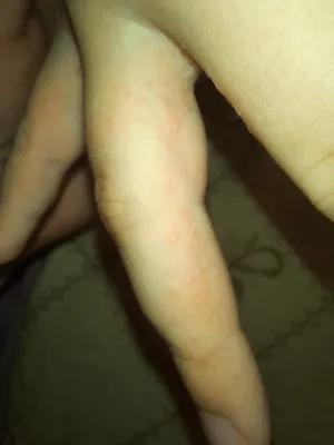 Фотография рук с мелкими высыпаниями и неровной кожей