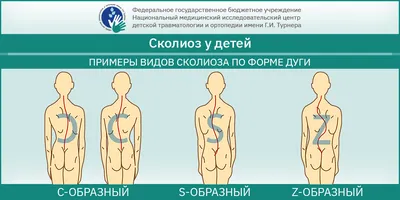 Вытяжение позвоночника - способ лечения сколиоза и нарушений осанки?