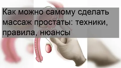 Успешное лечение простатита в СПб в клинике «Доктор»