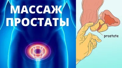 Как делать массаж простаты дома самому. Массаж предстательной железы -  повышение потенции у мужчин. - YouTube