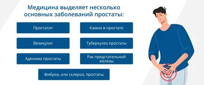 Развлекайся с пользой: массаж простаты дома - Отношения - info.sibnet.ru