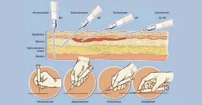 Как правильно делать внутримышечный укол — блог медицинского центра ОН  Клиник