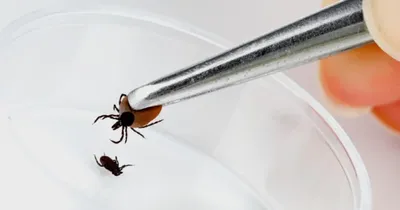 Что делать, если вас укусило насекомое | doc.ua