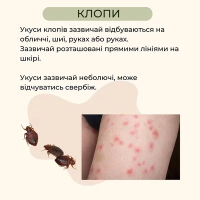 Врач назвала признаки опасных укусов насекомых - РИА Новости, 23.07.2021