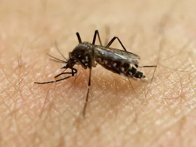 Укус комара: чем можно обработать кожу, чтобы избавиться от зуда