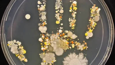 Микробы на руках: детальное изображение в формате WebP