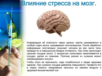 КТ головного мозга в Киеве — цена 900 грн в СДС на КТ головы