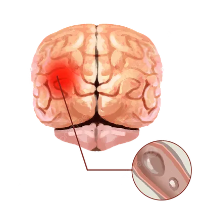 Мрт Головного Мозга — стоковые фотографии и другие картинки Мозг - Мозг,  Магнитно-резонансная томография, Магнитно-резонансный томограф - iStock