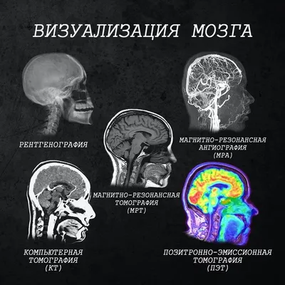 ▷ МРТ головного мозга в Киеве | МЦ ADONIS