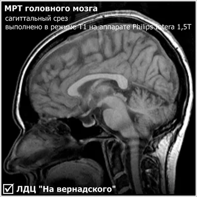 ➤ МРТ головного мозга, сосудов головы в Киеве - Цена в Лайфскан