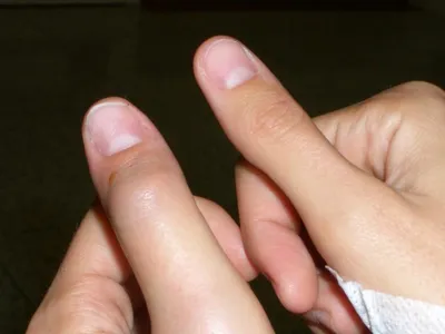 Изображение руки с шишкой: бесплатный контент в WebP
