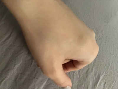 Изображение наростов на суставах пальцев рук: детальный кадр