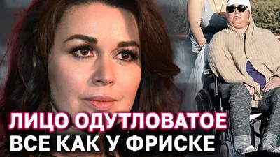 Анастасия Заворотнюк сейчас: последние новости о состоянии здоровья актрисы