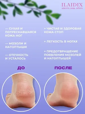 Крем для ног ARAVIA Professional для удаления мозолей и натоптышей Жидкий  педикюр Liquid Pedicure 150 мл купить по цене 482 ₽ в интернет-магазине  Детский мир