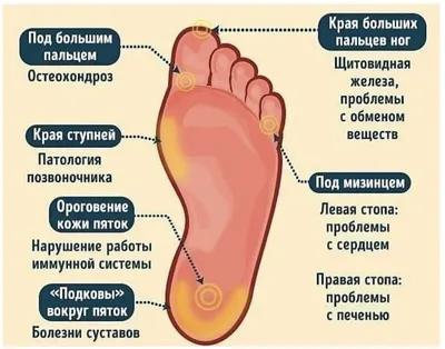 Как избавиться от мозолей на ногах: 7 действенных способов