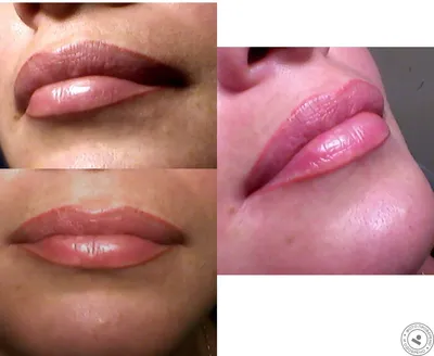 Фотография Натуральный татуаж губ до и после: сравнение разных форм губ
