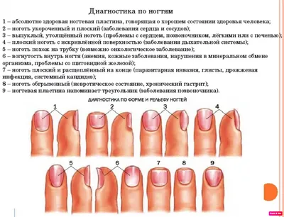 Негрибковые заболевания ногтей на руках фотографии
