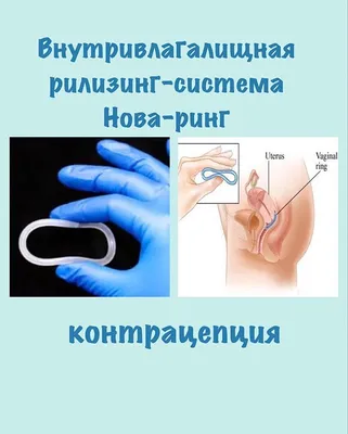 Отзыв о Противозачаточное кольцо Нова Ринг | Властелину колец и не снилось!  Максимум фото.