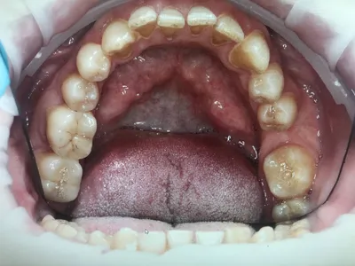 Как стоматологи нумеруют зубы: 4 приема для удобства работы и понимания  расположения | ВКонтакте