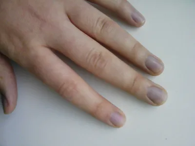 О чем говорят изменения цвета ногтей на руках: фото примеры