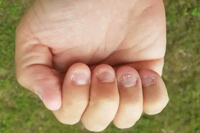 Ответы Mail.ru: Обгрызанные ногти ( фото)