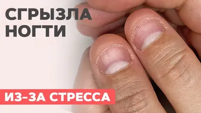 ногти грызуна. преображение. обкусанные ногти/часть 1 - YouTube | Acrylic  nail shapes, Nail shapes, Nails