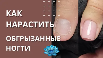 Маникюр на обгрызенных ногтях (ФОТО) - trendymode.ru