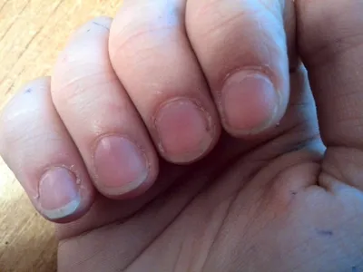 Наращивание ДЕФОРМИРОВАННЫХ ногтей/ Сложное наращивание/ ANKO NAIL -  YouTube | Акриловые ногти формы, Ногти, Форма ногтей