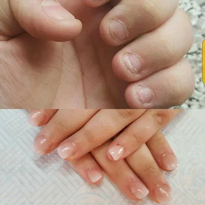 До и после. \"Обгрызенные ногти\" под-лак) | Гель-лак в Самаре | ВКонтакте