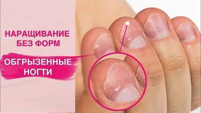 Грызи не хочу от обгрызания ногтей, цена 110 000 сум от ABC 24MARKET,  купить в Ташкенте, Узбекистан - фото и отзывы на Glotr.uz