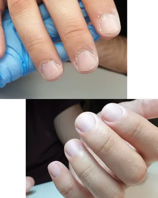 Маникюр на обгрызанные ногти без наращивания (21 фото)