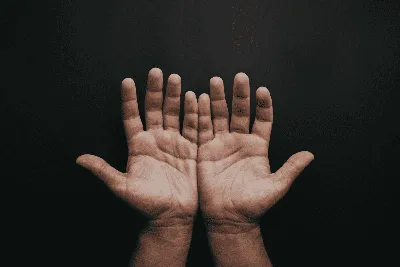 Фотография рук с сильной шелушащейся кожей