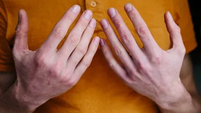 Обморожение пальцев рук: изображения для блога о погоде