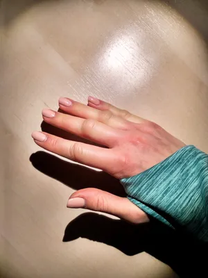 Картинка об обморожении рук