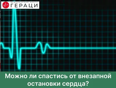 Остановка сердца: признаки, причины, первая помощь, лечение, профилактика в  домашних условиях