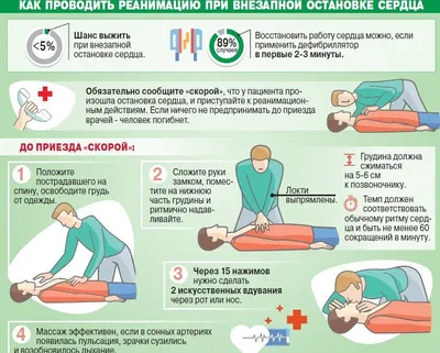 Остановка Сердца Экг — стоковые фотографии и другие картинки Болезнь -  Болезнь, В сеточку, Волновой рисунок - iStock