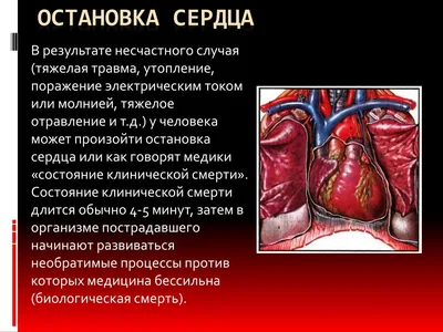 Остановка сердца» — создано в Шедевруме