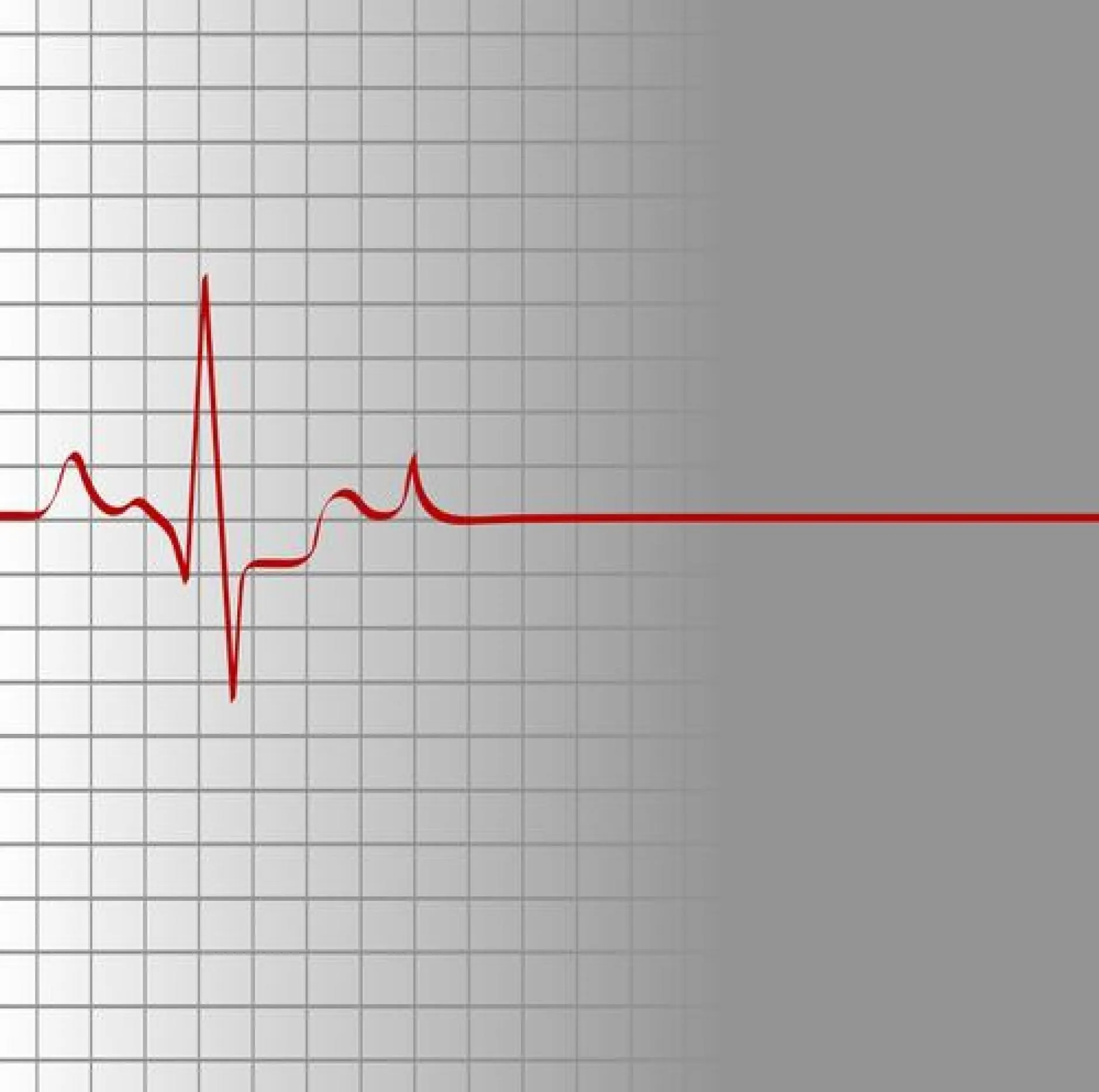 Остановка сердца на ЭКГ. Сердце с линией кардиограммы. Кардиограмма смерти. Прямая линия на кардиограмме. Сердцебиение остановилось