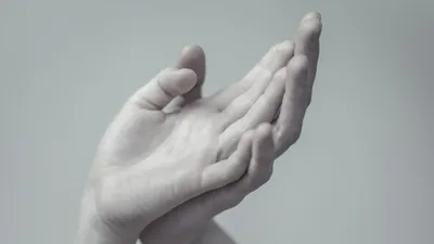 Фотография рук с диагнозом остеоартроз пальцев