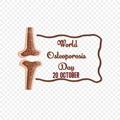 КТ признаки остеопороза | Второе мнение