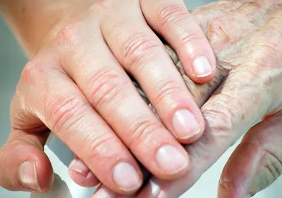 Остеопороз кистей рук: картинки для диагностики и лечения