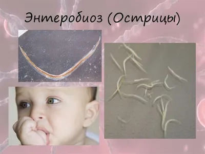 Лечение глистов гомеопатией, при острицах, Киев