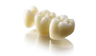 Изумительное изображение Открытый Канал Зуба: как сохранить здоровье зубов