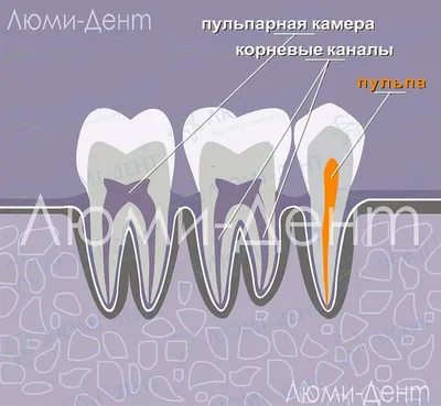 Фото открытого канала зуба: какие симптомы нужно знать?