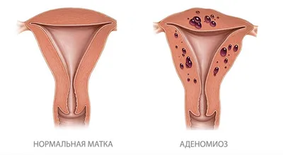 Надпочечники. Тестостерон. Овуляция После нашей статьи в ленте про  надпочечники и овуляцию, от вас часто поступают вопросы, как правильно… |  Instagram