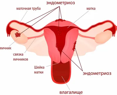 Менструальный цикл в картинке - Гинеколог Плюс